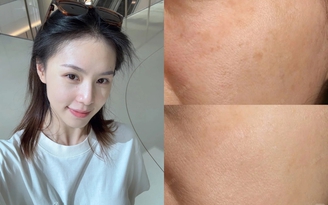 Top 6 serum mờ nám, tàn nhang sau khoảng 4 tuần khiến chị em đều không tin