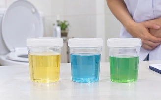 Nước tiểu xanh dương, xanh lá: Khi nào cần đi khám?