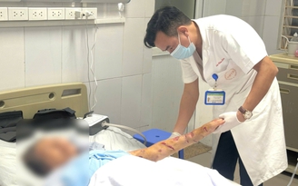 Cẩn trọng khi nhà có chó nuôi con