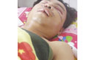 Giữa đêm đang ngủ, bất ngờ bị chém
