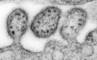 40 người chết vì cúm Lassa ở Nigeria