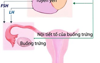 Chăm sóc buồng trứng - một vấn đề thiết yếu