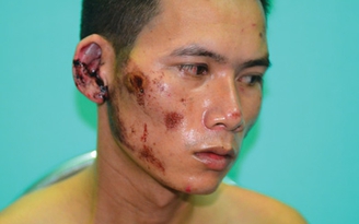 Công an phường bị tố lột đồ, đánh người say rượu