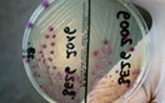 Giải mã được dòng khuẩn E.coli chết chóc