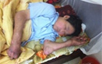 Bệnh gút tấn công giới trẻ
