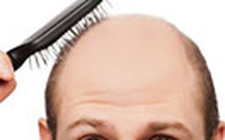 Giải quyết chứng hói đầu