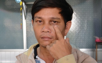 Trung úy công an bị cắn đứt lóng tay