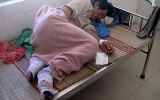 Cả nhà bị bỏng do xăng