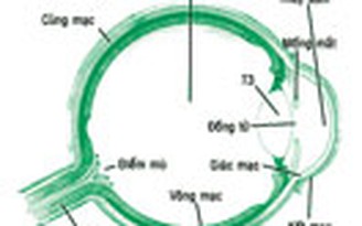 Nên làm gì khi bị đỏ mắt, xốn mắt