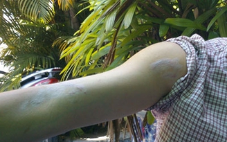 Kiến ba khoang “tấn công” khu chung cư