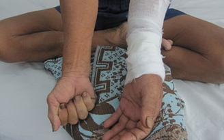 Đắp thuốc vô tội vạ, có thể phải cắt bỏ tay chân