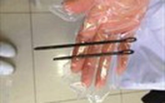 Cãi nhau với bạn gái, nuốt chửng 2 cây đinh