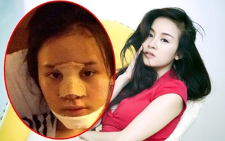 Bà Tưng lộ ảnh khuôn mặt 'hư hao' vì dao kéo