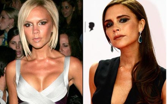 Victoria Beckham xác nhận đã tháo túi độn ngực