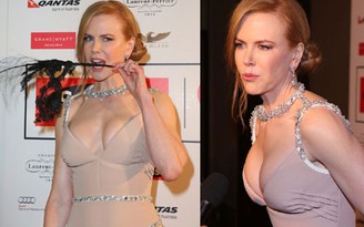 Nicole Kidman lộ 'vòng 1' to bất thường