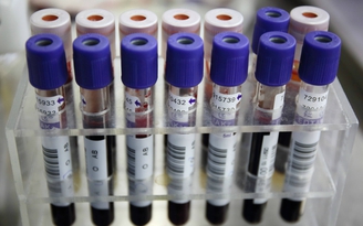 Trung Quốc khẳng định lô huyết tương âm tính với HIV