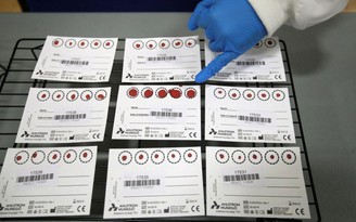 Tây Ban Nha chia sẻ miễn phí công nghệ phát hiện kháng thể với WHO
