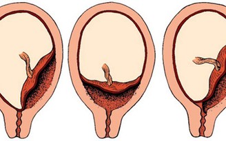 Placenta là gì? Có tốt cho da hay không?