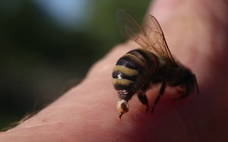 Làm dịu vết ong chích bằng những cách đơn giản