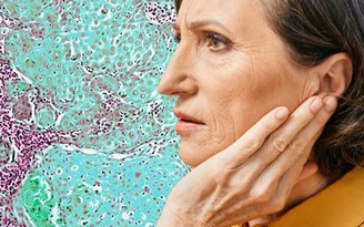 Triệu chứng kỳ lạ ở tai tiết lộ bạn có thể bị ung thư miệng
