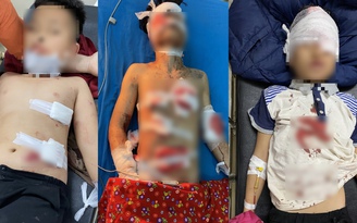 4 học sinh Tuyên Quang nhập viện do pháo tự chế phát nổ