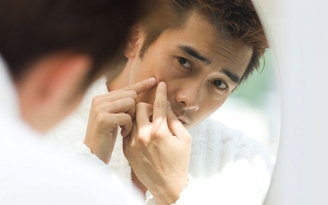 Mụn đầu đen: Những điều nên và không nên làm