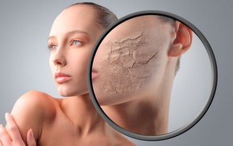 Kem dưỡng ẩm có thật sự cần thiết cho làn da nhờn?