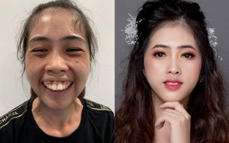Top những gương mặt ‘vịt hóa thiên nga’ thành công tại Việt Nam