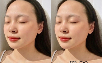 Sở hữu làn da trắng sáng, mịn màng cùng Lam Beauty Clinic