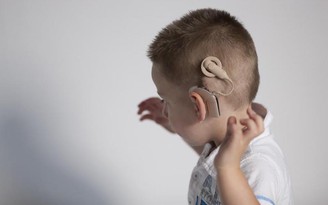 Sự khẩn cấp trong điều trị khiếm thính cho trẻ em
