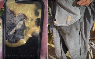 Người đàn ông kiện Apple vì iPhone X phát nổ trong túi quần