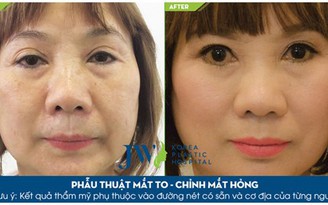 Bác sĩ chuyên phẫu thuật thẩm mỹ mắt hỏng sắp đến Việt Nam