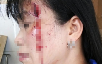 Công an điều tra vụ 'một tiểu thương bị bảo vệ chợ đánh nhập viện'