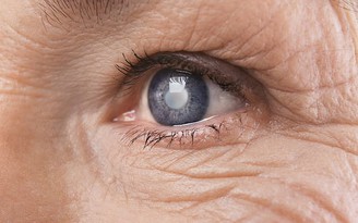 Phương pháp điều trị đột phá giúp chữa vết thương ở mắt do bị tạt a xít
