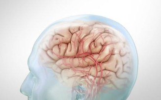 5 dấu hiệu cho thấy bạn đang có một cơn đột quỵ não