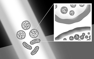 Laser xung siêu ngắn có khả năng tiêu diệt siêu vi khuẩn và bào tử vi khuẩn