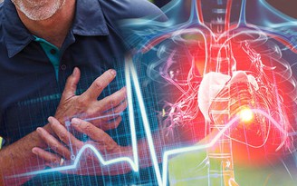 Chuyên gia hướng dẫn các bước cứu mạng nếu đau tim khi một mình