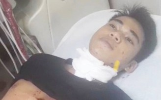 Tây Ninh: Sát hại bạn gái trong nhà nghỉ rồi dùng dao tự cắt vào cổ