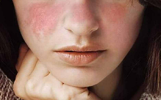 Làm thế nào để kiểm soát làn da khô khỏi bong tróc vào mùa đông ? Làm thế nào để kiểm soát làn da khô khỏi bong tróc vào mùa đông ?
