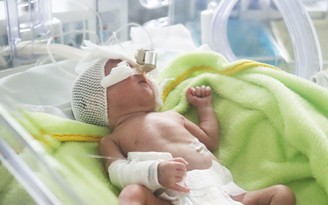 Sinh non: Nguyên nhân tử vong hàng đầu ở trẻ sơ sinh