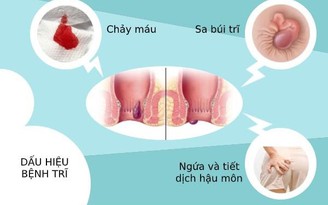 Bệnh trĩ có tự khỏi không?