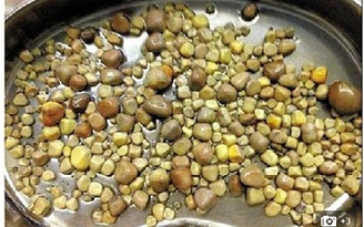 Kinh hoàng quả thận chứa 420 viên sỏi