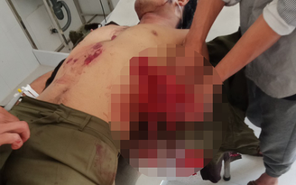 Lâm Đồng: Chuyển nạn nhân tự chế mìn gây nổ phải cắt bàn tay lên tuyến trên