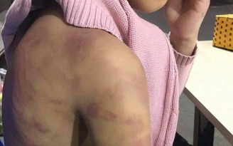Hà Nội: Nghi án bé gái 12 tuổi bị mẹ ruột và người tình bạo hành, xâm hại