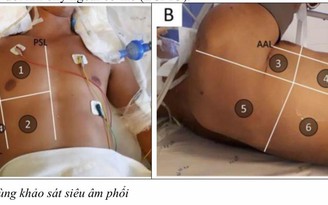 Nhận biết dấu hiệu mắc Covid-19 do chủng Delta gây bệnh nặng