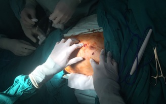 Bệnh nhân bỗng lấy kéo tự đâm thủng tim, phổi của mình