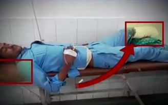 Bàn chân đứt lìa lại bị dùng làm gối đầu, 2 bác sĩ bị đình chỉ