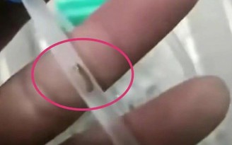 Phát hiện giun trong ống truyền dịch cho bé trai tại bệnh viện Trung Quốc
