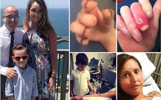 Bị bệnh, người phụ nữ buộc phải cắt ngón tay và ngón chân 30 lần