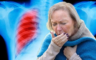 Ho như thế nào là dấu hiệu của ung thư phổi?